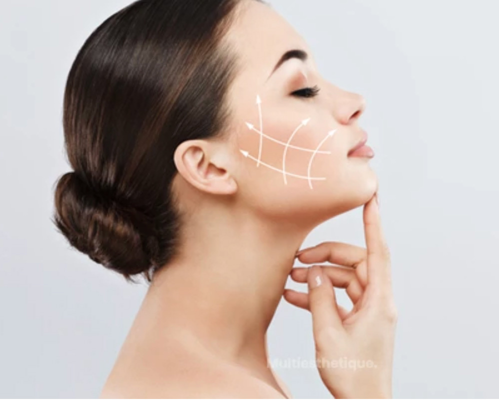 endopeel-fr