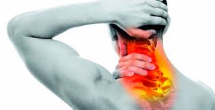 Torticollis