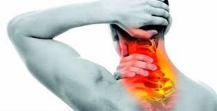 Torticollis